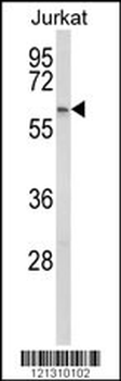 PCCB Antibody (Center)