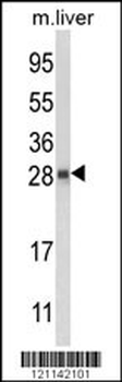 QDPR Antibody (C-term)