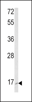 RAC2 Antibody (C-term)