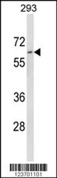 DOLK Antibody (Center)