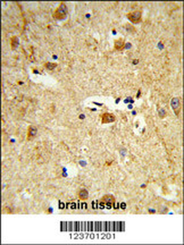 DOLK Antibody (Center)