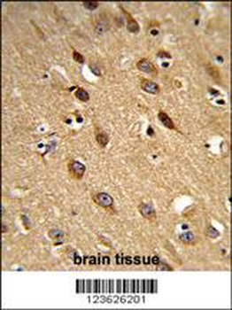PISD Antibody (Center)