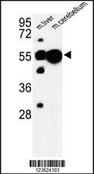 UBAP1 Antibody (N-term)