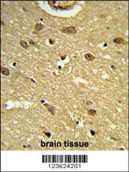 UBAP1 Antibody (N-term)