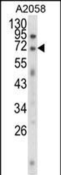 EWSR1 Antibody (C-term)
