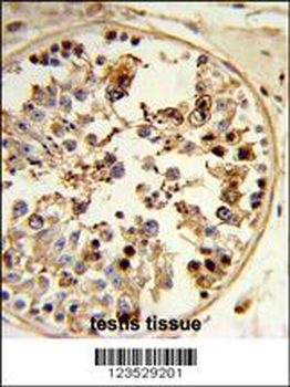 ASPSCR1 Antibody (C-term)