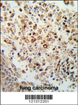 FPRL2 Antibody (Center)