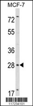 RASL11B Antibody (N-term)