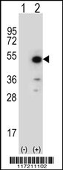 PPID Antibody (N-term)