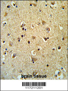 PPID Antibody (N-term)