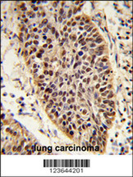 XPA Antibody (C-term)