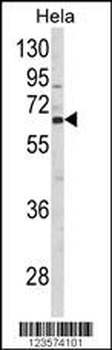 CTPS2 Antibody (N-term)