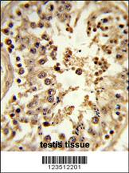 CDC42EP3 Antibody (N-term)