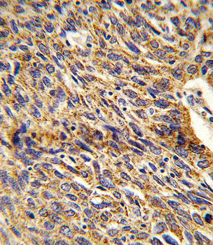 DCI Antibody (C-term)