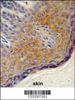 DERA Antibody (N-term)