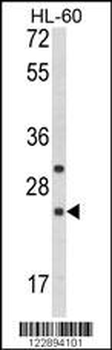 RGS1 Antibody (N-term)