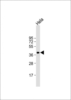ARPC1B Antibody (Center)