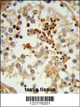 HSPA4L Antibody (C-term)