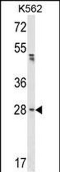 FNDC5 Antibody (C-term)