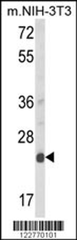 DERL1 Antibody (C-term)