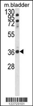 CCDC3 Antibody (C-term)