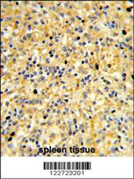 CCDC3 Antibody (C-term)