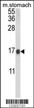 LGALS2 Antibody (Center)