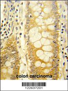 LGALS2 Antibody (Center)