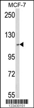 SKIV2L2 Antibody (Center)