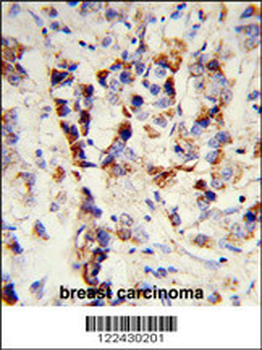 SKIV2L2 Antibody (Center)