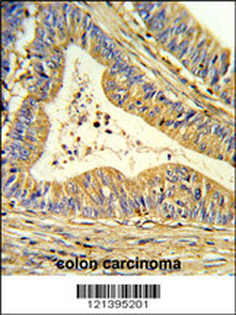 SOD1 Antibody (Center)