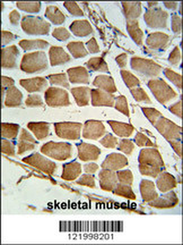 CARD4 Antibody (C-term)