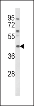 MC3R Antibody (Center)