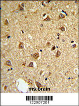 DIO2 Antibody (Center)