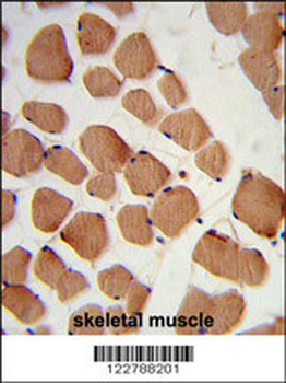 PHYH2 Antibody (C-term)