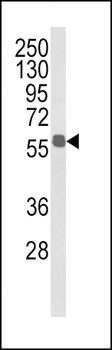 ALDH3B1 Antibody (Center)