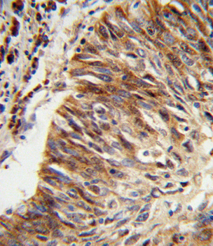 ALDH3B1 Antibody (Center)