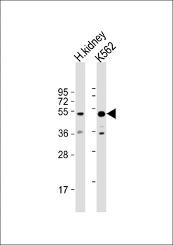ALDH3B1 Antibody (Center)