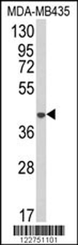 AGPAT4 Antibody (Center)