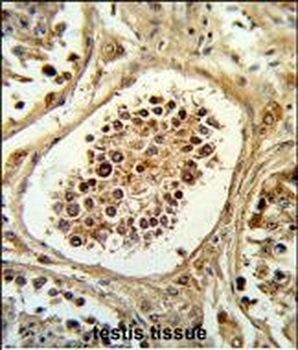 EGLN2 Antibody (Center)