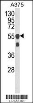 VIME Antibody
