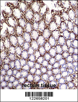 VIME Antibody