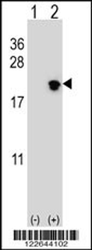 NIP7 Antibody (C-term)