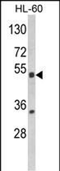 NR1I2 Antibody (Center)
