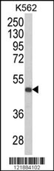 KIR3DS1 Antibody (C-term)