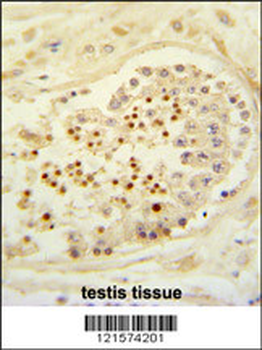 CBLB Antibody (Center)