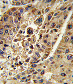 KMO Antibody (Center)