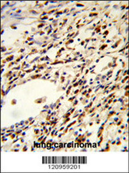 FLCN Antibody (Center)
