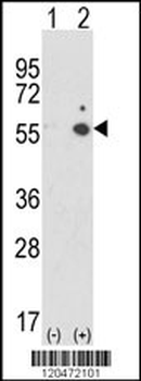ICAM1 Antibody (C-term)