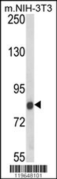 TARSL2 Antibody (Center)